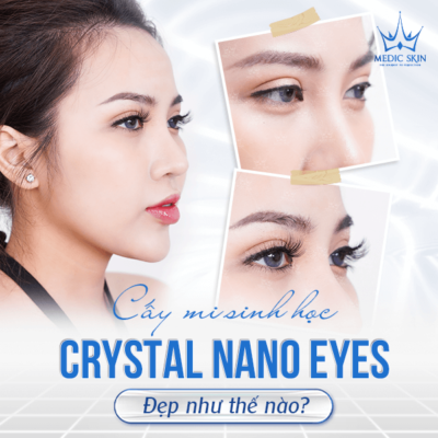 cấy mi sinh học nano crystal eyes medic skin