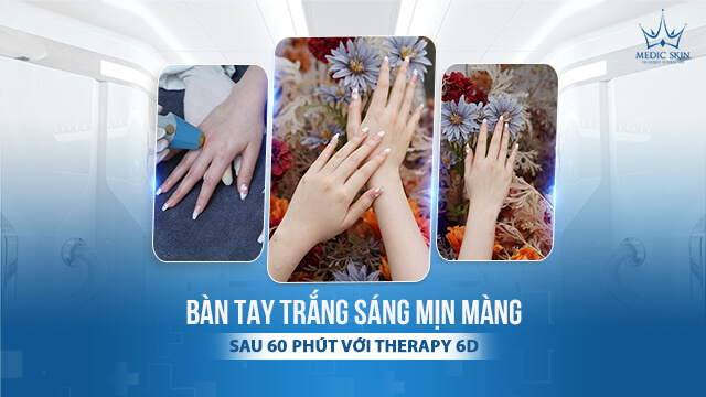 Bàn tay thô ráp sau 60 phút trở nên trắng sáng mịn bằng công nghệ Therapy 6D