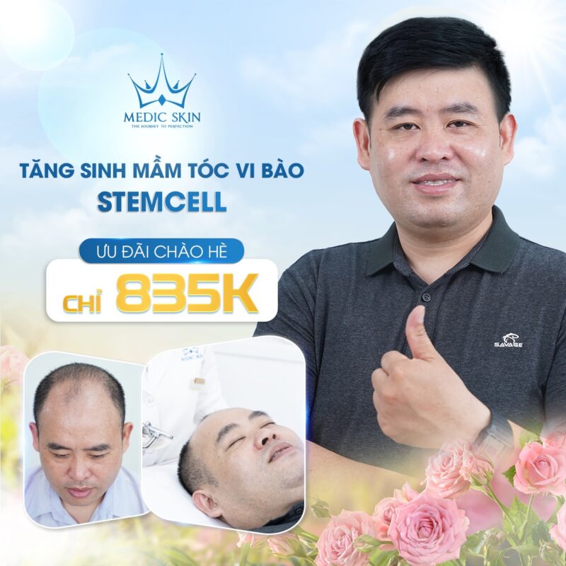 Tăng sinh mầm tóc vi bào Stem Cell: chỉ 835K