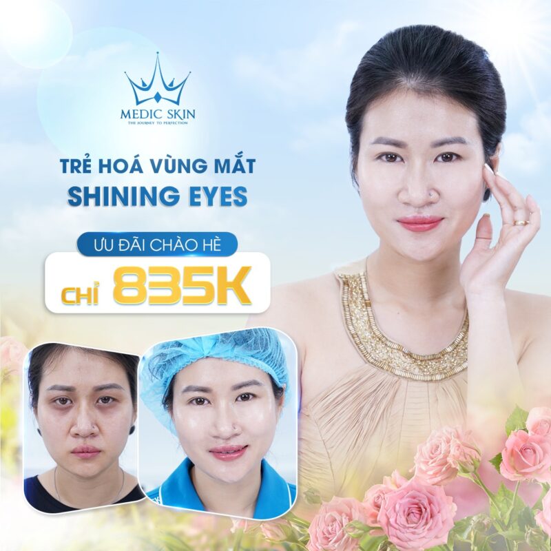 Trẻ hóa mắt Shining Eyes: Chỉ 835k - Tặng 1 buổi chăm sóc da mặt chuyên sâu