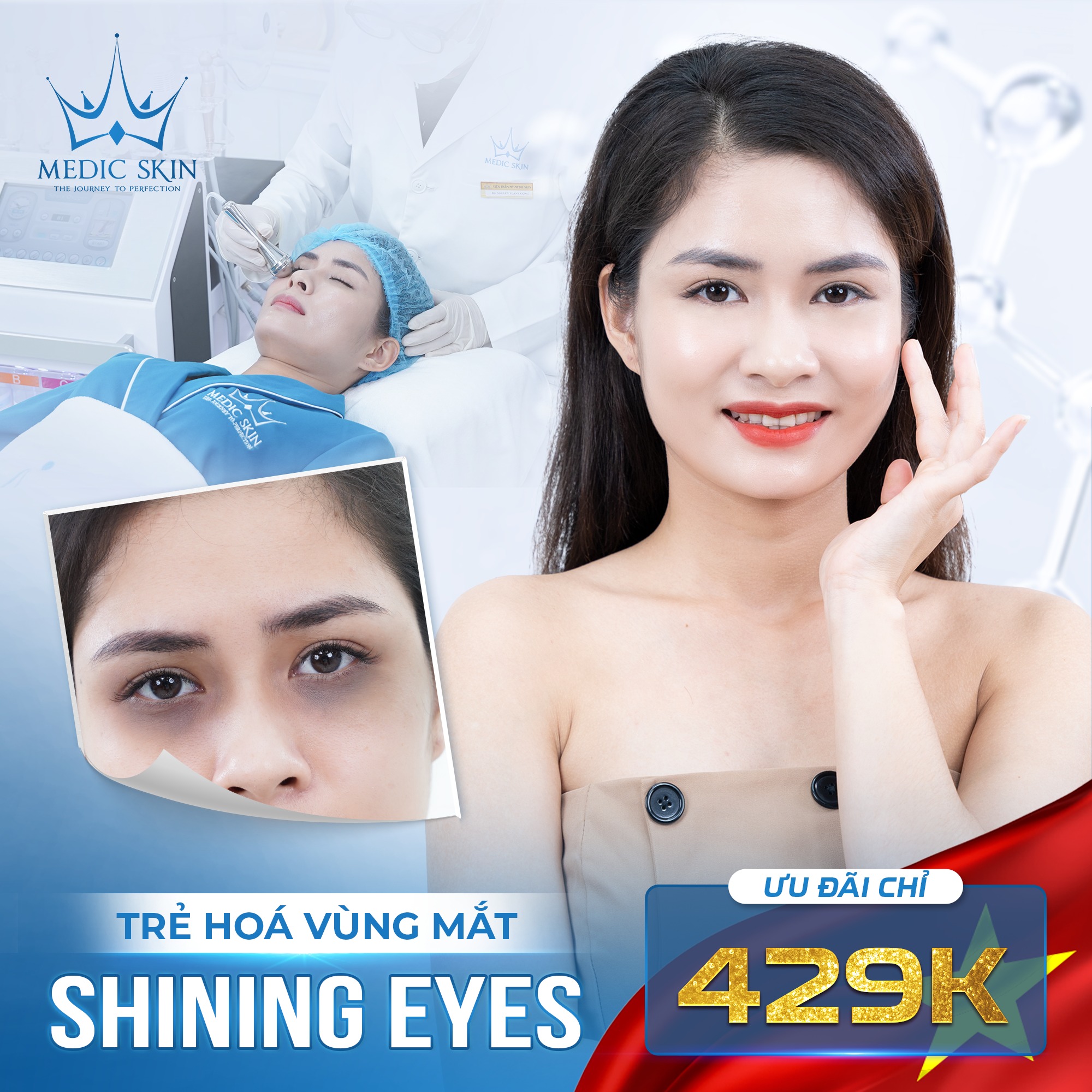Trẻ hóa vùng mắt Shining Eyes: chỉ 429K 